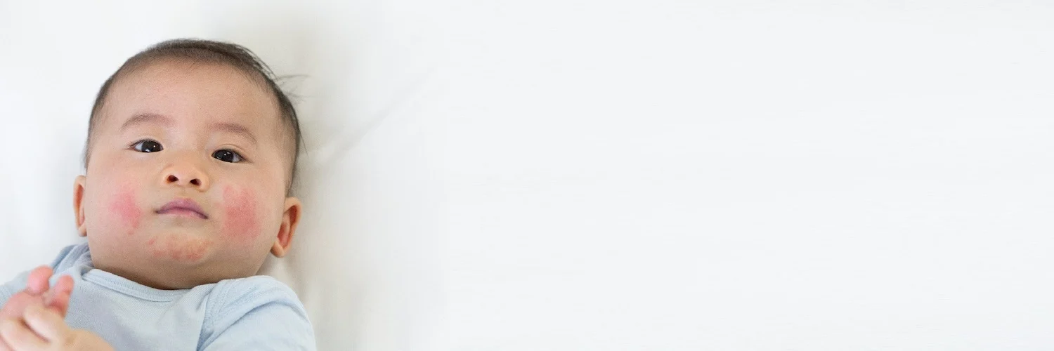 Common dermatological condition requiring dermatology specialist care