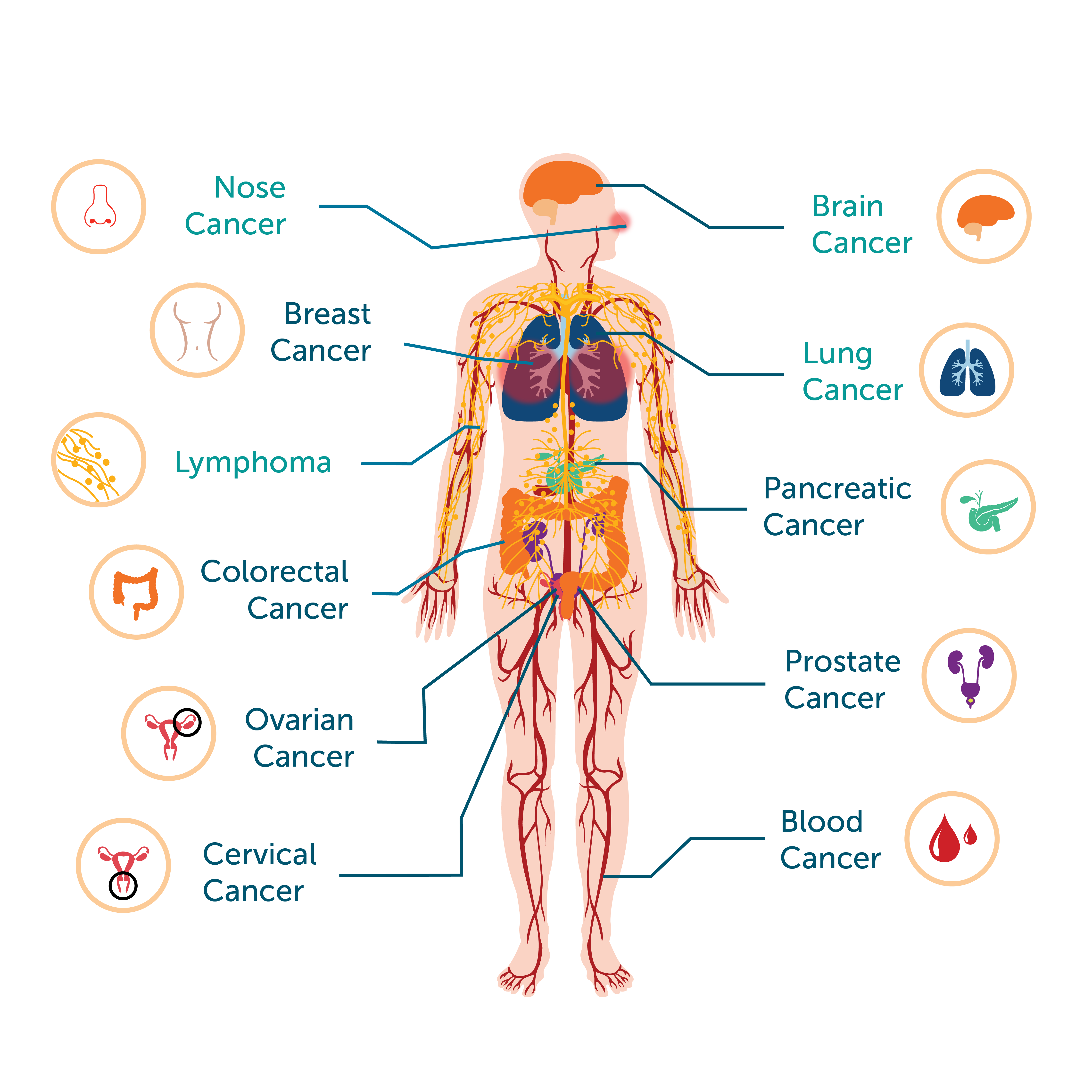 different types of cancer in the human body